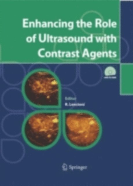 Riccardo Lencioni - Enhancing the Role of Ultrasound with Contrast Agents, E-bok