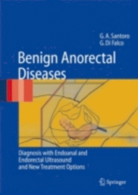 Giuseppe Di Falco, Giulio Aniello Santoro - Benign Anorectal Diseases, E-bok