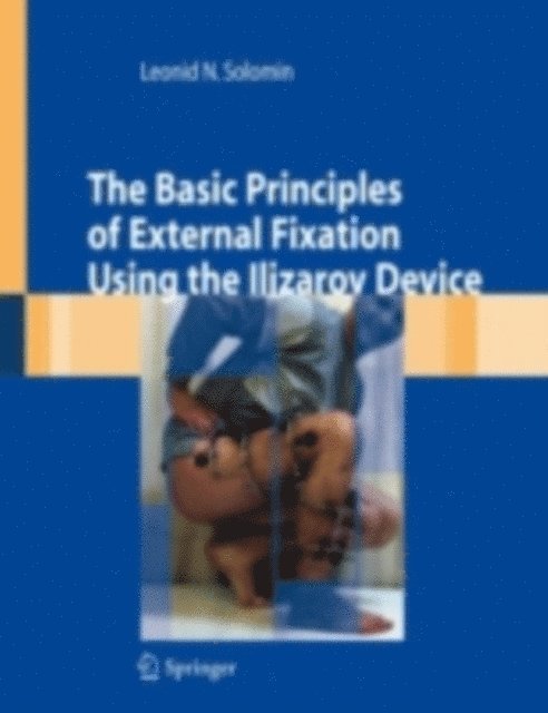 Leonid Solomin - Basic Principles of External Skeletal Fixation Using the Ilizarov Device, E-bok