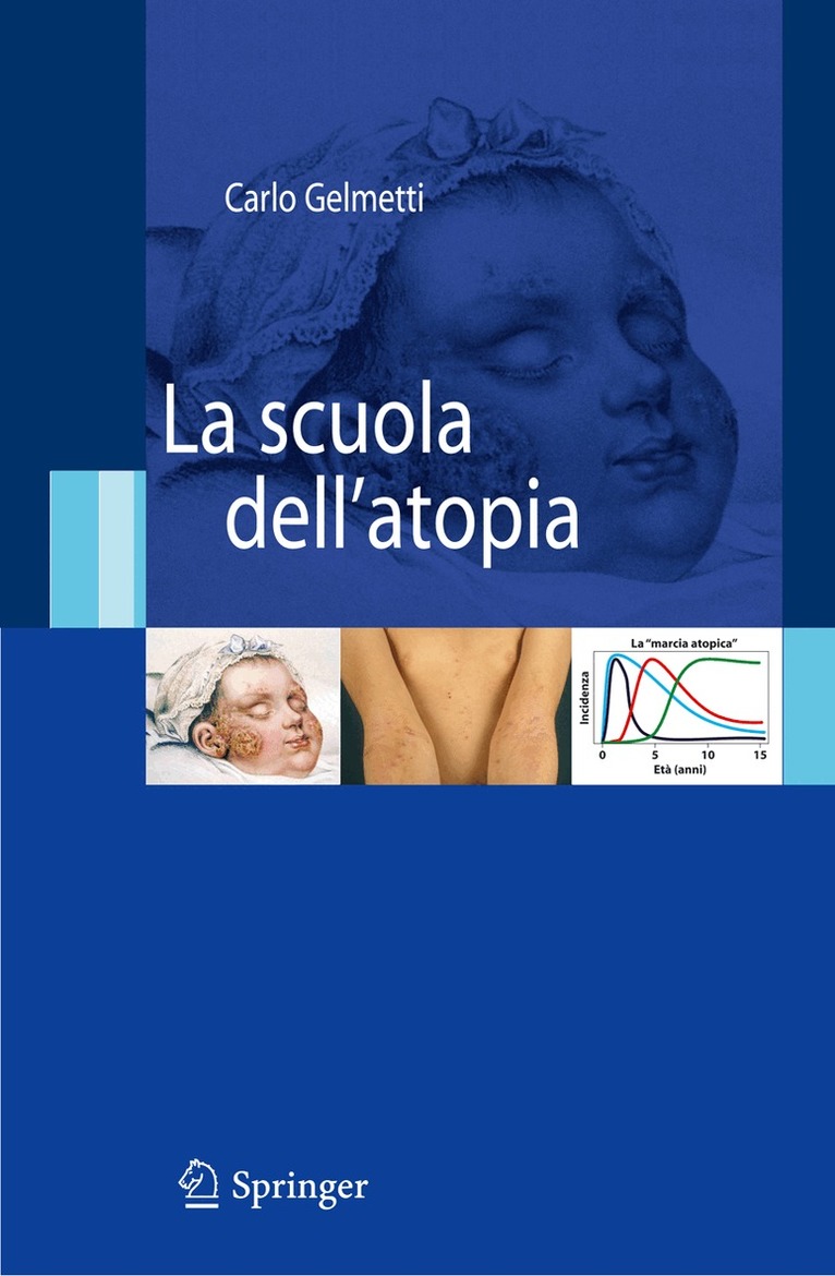 Carlo Gelmetti - La scuola dell'atopia, Inbunden. Tillgänglighet: Lägg i varukorg