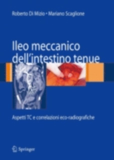 Mariano Scaglione, Roberto Di Mizio - Ileo meccanico dell'intestino tenue, E-bok