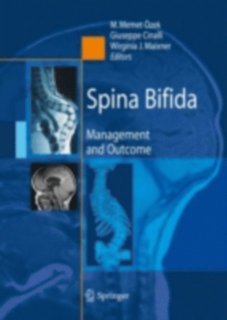 Wirginia Maixner, Giuseppe Cinalli, M. Memet Ozek - Spina Bifida, E-bok