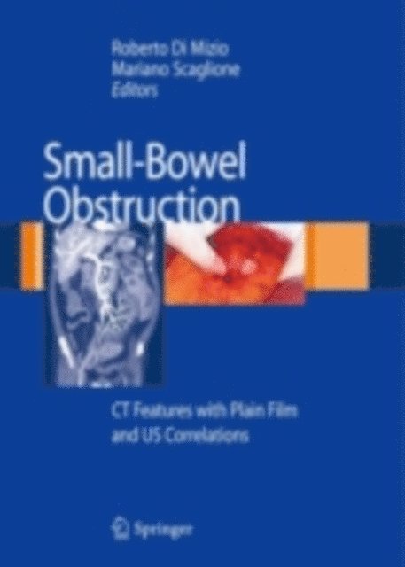 Mariano Scaglione, Roberto Di Mizio - Small-Bowel Obstruction, E-bok