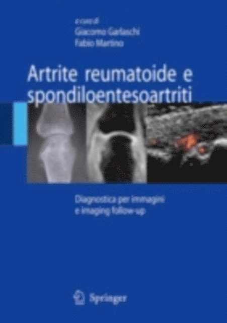 Fabio Martino, Giacomo Garlaschi - Artrite reumatoide e spondiloentesoartriti, E-bok