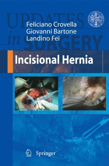 Landino Fei, Giovanni Bartone, Feliciano Crovella - Incisional Hernia, E-bok