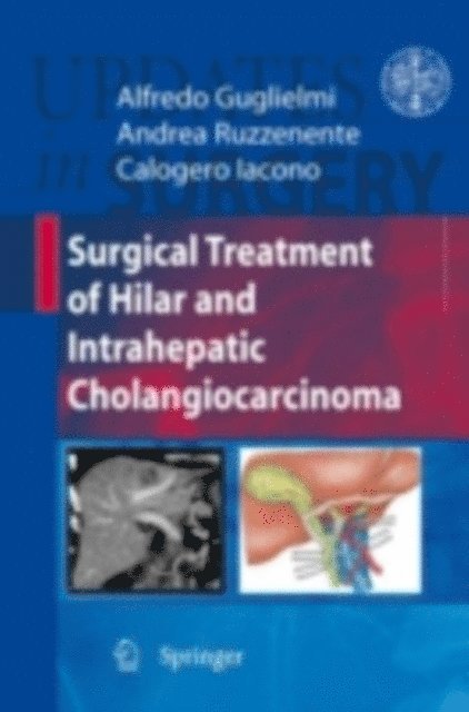 Calogero Iacono, Andrea Ruzzenente, Alfredo Guglielmi - Surgical Treatment of Hilar and Intrahepatic Cholangiocarcinoma, E-bok