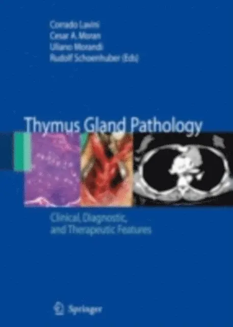 Rudolf Schoenhuber, Uliano Morandi, Cesar A. Moran, Corrado Lavini - Thymus Gland Pathology, E-bok. Tillgänglighet: Lägg i varukorg