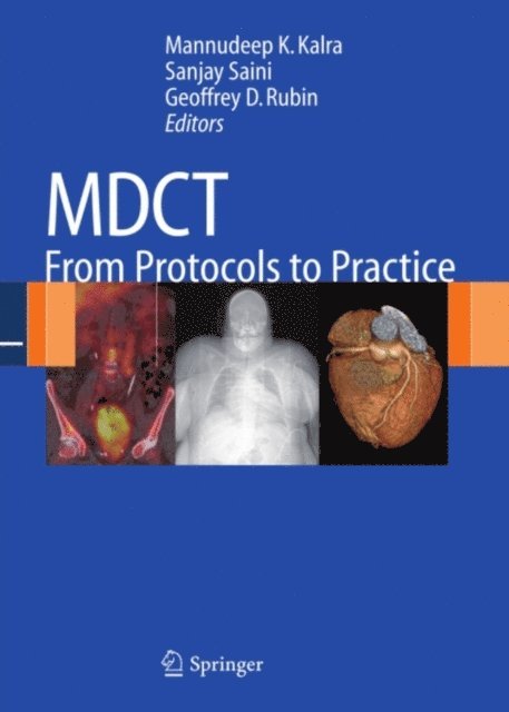 Geoffrey D. Rubin, Sanjay Saini, Mannudeep K. Kalra - MDCT, E-bok