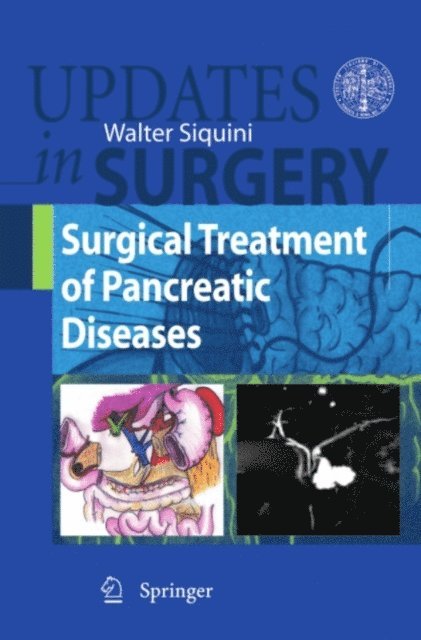 Walter Siquini - Surgical Treatment of Pancreatic Diseases, E-bok