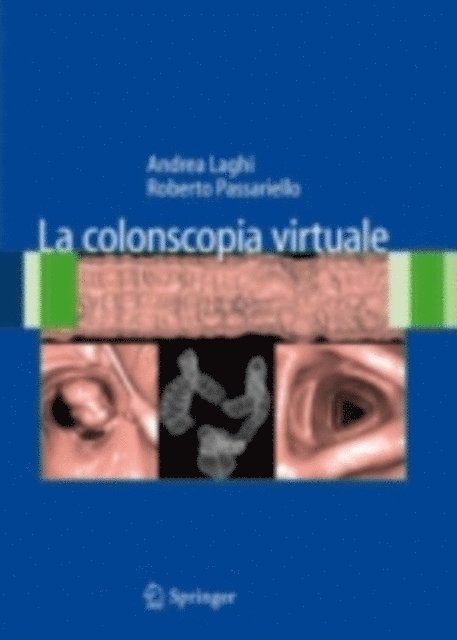 Roberto Passariello, Andrea Laghi - La colonscopia virtuale, E-bok