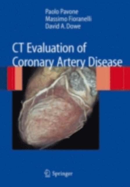 David A. Dowe, Massimo Fioranelli, Paolo Pavone - CT Evaluation of Coronary Artery Disease, E-bok