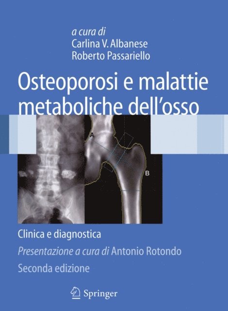 Roberto Passariello, Carlina V. Albanese - Osteoporosi e malattie metaboliche dell'osso, E-bok