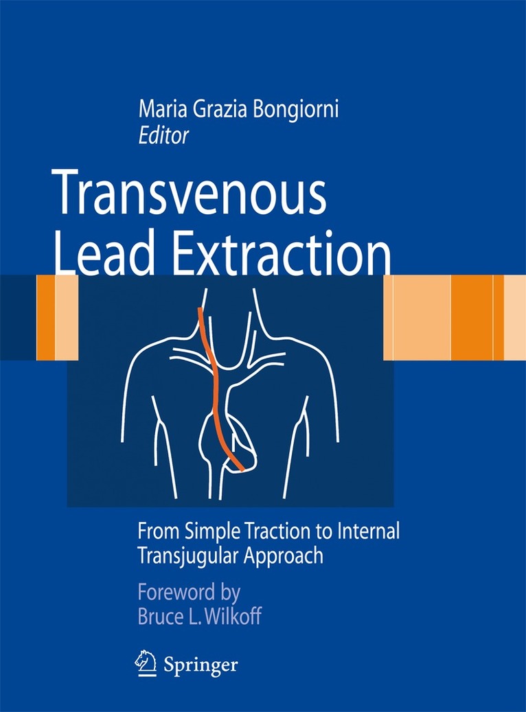 Maria Grazia Bongiorni - Transvenous Lead Extraction, Inbunden. Tillgänglighet: Lägg i varukorg