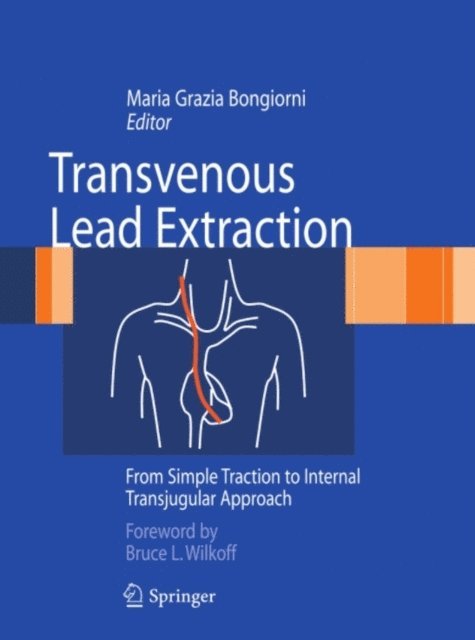 Maria Grazia Bongiorni - Transvenous Lead Extraction, E-bok. Tillgänglighet: Lägg i varukorg