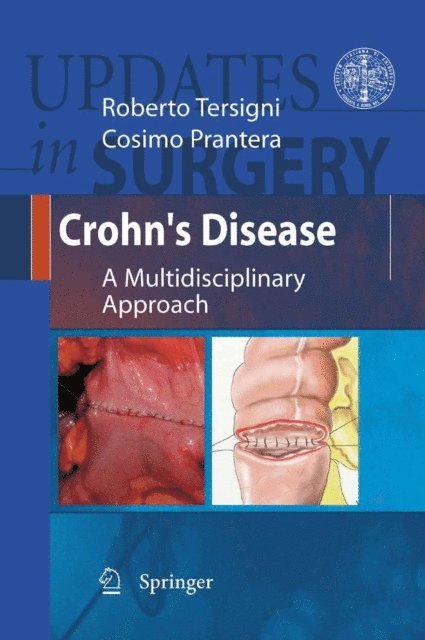 Cosimo Prantera, Roberto Tersigni - Crohn's Disease, E-bok