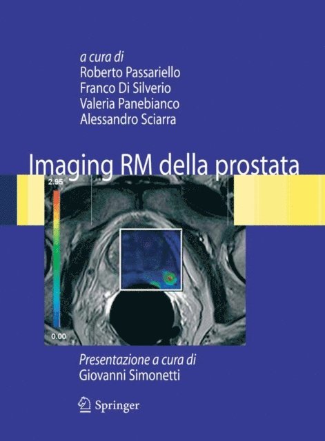Alessandro Sciarra, Valeria Panebianco, Franco Di Silverio, Roberto Passariello - Imaging RM della prostata, E-bok