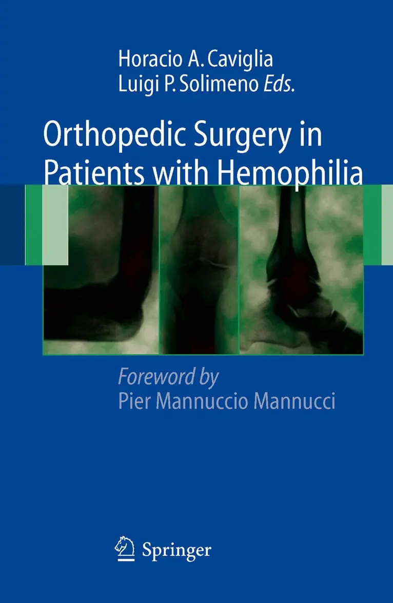 Horacio A. Caviglia, Luigi Piero Solimeno - Orthopedic Surgery in Patients with Hemophilia, Häftad. Tillgänglighet: Lägg i varukorg