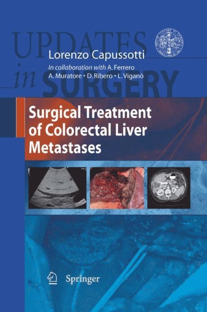 Lorenzo Capussotti - Surgical Treatment of Colorectal Liver Metastases, E-bok