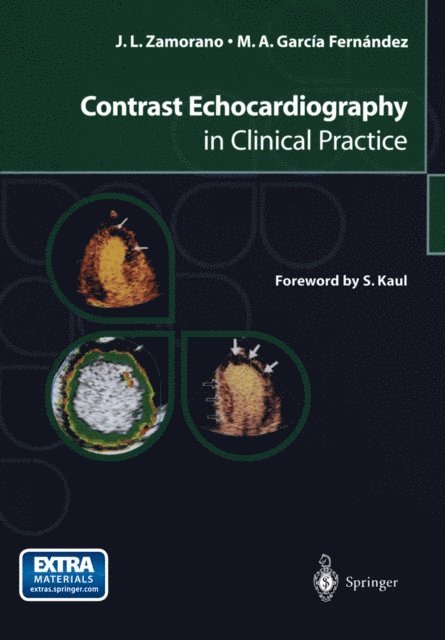 Miguel A. Garcia Fernandez, Jose L. Zamorano - Contrast Echocardiography in Clinical Practice, E-bok