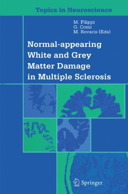 M. Rovaris, G. Comi, M. Filippi - Normal-appearing White and Grey Matter Damage in Multiple Sclerosis, E-bok