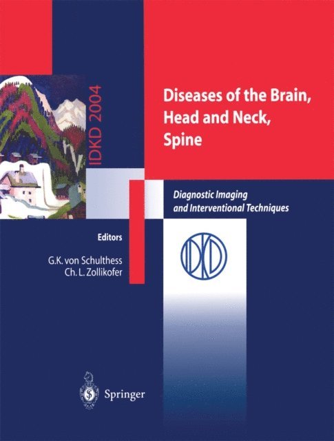 Christoph L. Zollikofer, Gustav K. Schulthess - Diseases of the Brain, Head and Neck, Spine, E-bok