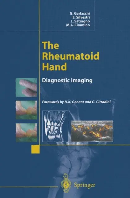 M.A. Cimmino, L. Satragno, E. Silvestri, G. Garlaschi - Rheumatoid Hand, E-bok. Tillgänglighet: Lägg i varukorg