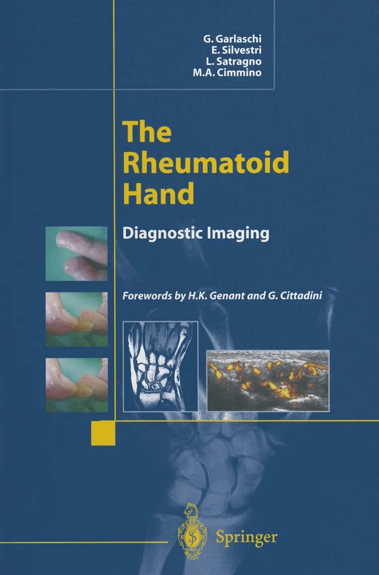 G. Garlaschi, E. Silvestri, L. Satragno, M.A. Cimmino, G. Garlaschi, E. Silvestri - Rheumatoid Hand, Häftad. Tillgänglighet: Lägg i varukorg