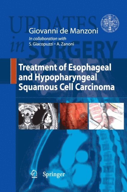 Giovanni De Manzoni - Treatment of Esophageal and Hypopharyngeal Squamous Cell Carcinoma, E-bok