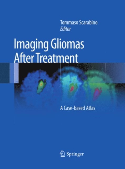Tommaso Scarabino - Imaging Gliomas After Treatment, E-bok