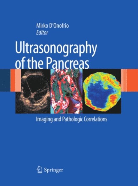Mirko D'Onofrio - Ultrasonography of the Pancreas, E-bok