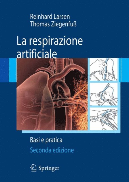 Thomas Ziegenfu, Reinhard Larsen - La respirazione artificiale, E-bok