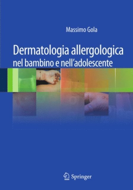 Massimo Gola - Dermatologia allergologica nel bambino e nell'adolescente, E-bok