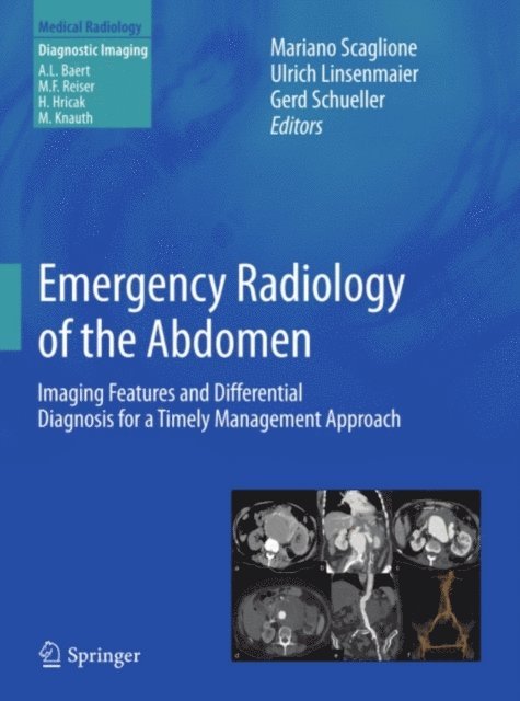 Gerd Schueller, Ulrich Linsenmaier, Mariano Scaglione - Emergency Radiology of the Abdomen, E-bok