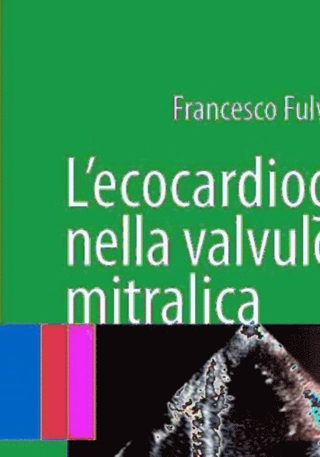 Francesco Fulvio Faletra - L'ecocardiografia nella valvulopatia mitralica, E-bok
