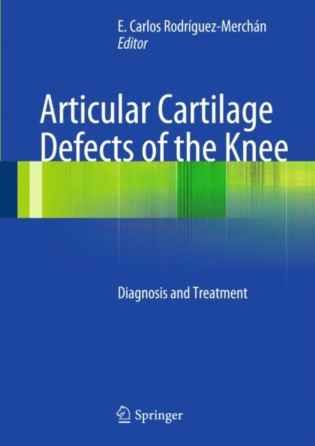 E. Carlos Rodriguez-Merchan - Articular Cartilage Defects of the Knee, E-bok