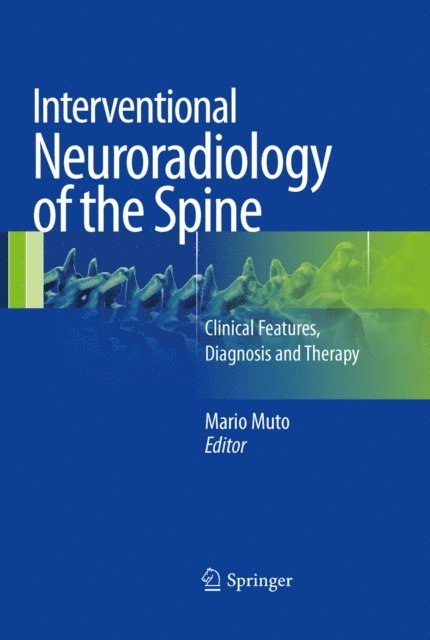 Mario Muto - Interventional Neuroradiology of the Spine, E-bok