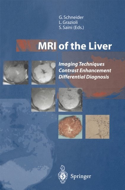 Sanjay Saini, Luigi Grazioli, Gunther Schneider - MRI of the Liver, E-bok