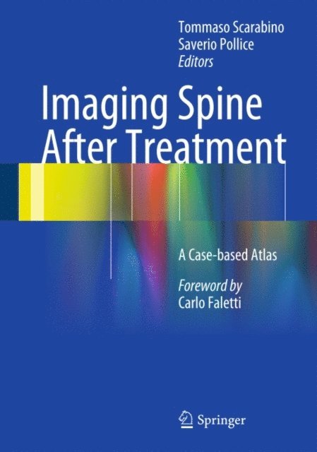 Saverio Pollice, Tommaso Scarabino - Imaging Spine After Treatment, E-bok