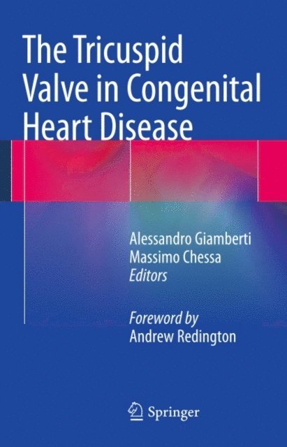 Massimo Chessa, Alessandro Giamberti - Tricuspid Valve in Congenital Heart Disease, E-bok