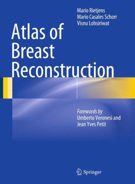 Visnu Lohsiriwat, Mario Casales Schorr, Mario Rietjens - Atlas of Breast Reconstruction, E-bok. Tillgänglighet: Lägg i varukorg