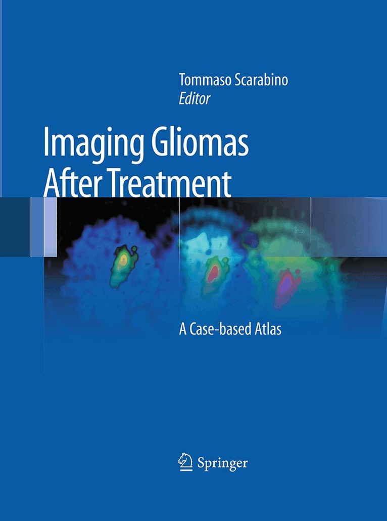 Tommaso Scarabino - Imaging Gliomas After Treatment, Häftad