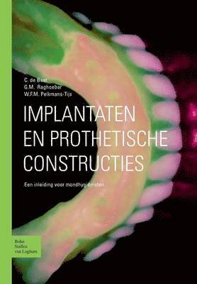 C De Baat, W F M Pelkmans-Tijs, G M Raghoebar - Implantaten En Prothetische Constructies, Häftad