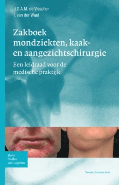 I. van der Waal, J.G.A.M. de Visscher - Zakboek mondziekten, kaak- en aangezichtschirurgie, E-bok