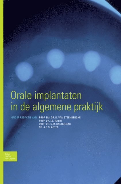A.P. Slagter, G.M. Raghoebar, I.E. Naert, D. van Steenberghe - Orale implantaten in de algemene praktijk, E-bok