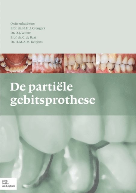 D.J. Witter, H.M.A.M. Keltjens, N.H.J. Creugers - De partiële gebitsprothese, E-bok