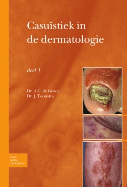Johan Toonstra, Anton C. Groot - Casuïstiek in de dermatologie - deel I, E-bok