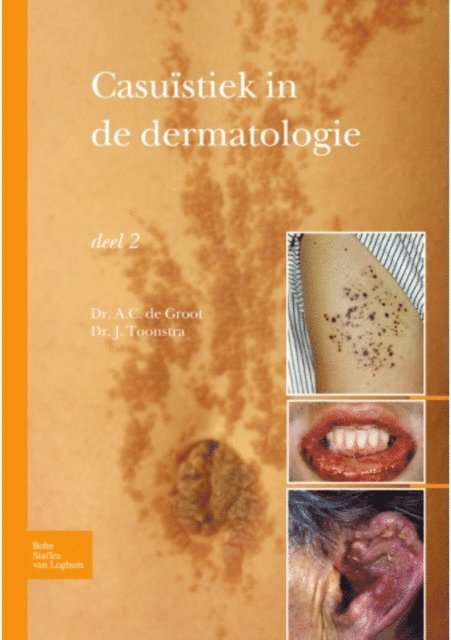Johan Toonstra - Casuïstiek in de dermatologie - deel 2, E-bok