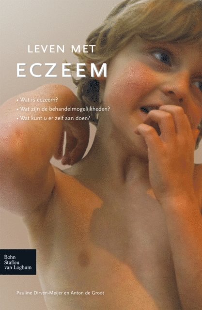 Anton  C. de Groot, P.E. Dirven-Meyer, Anton  C. de Groot, P.C. Dirven Meijer - Leven met eczeem, E-bok