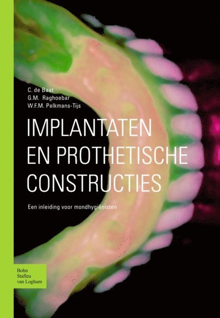 G.M. Raghoebar, W.F.M. Pelkmans-Tijs, C. de Baat - Implantaten en prothetische constructies, E-bok
