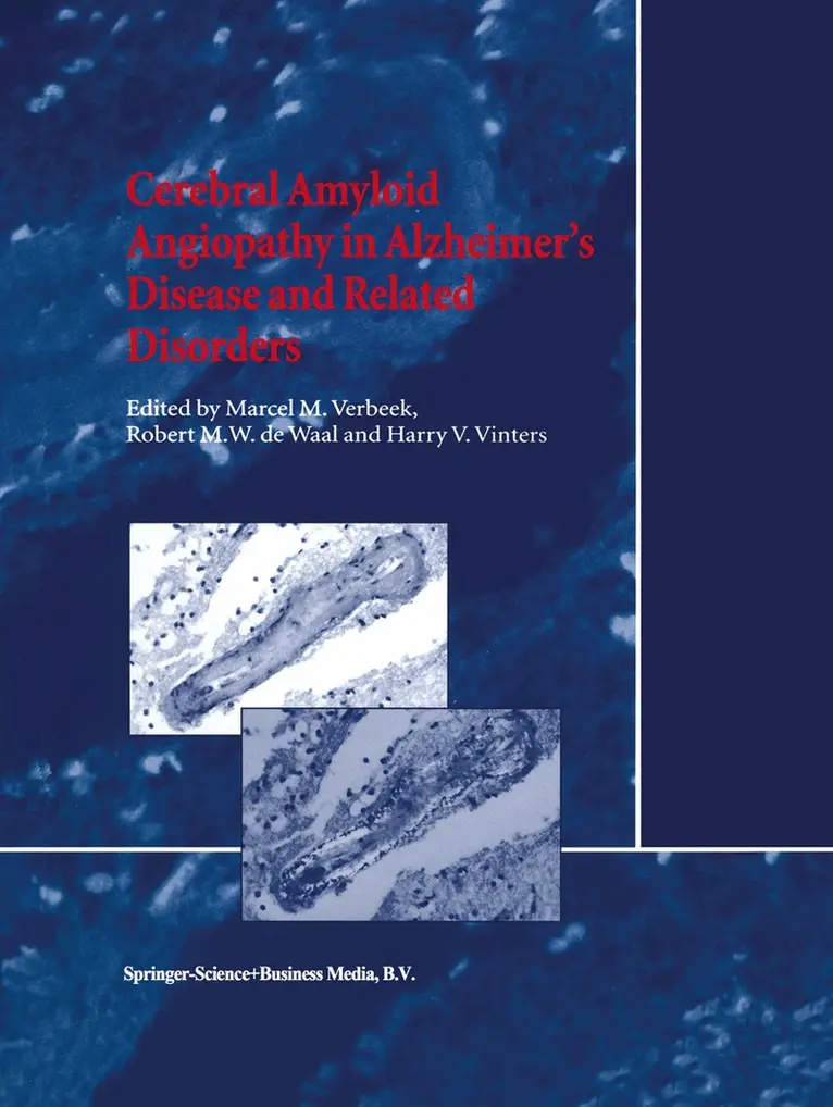 M.M. Verbeek, R.M. de Waal, Harry V. Vinters - Cerebral Amyloid Angiopathy in Alzheimer’s Disease and Related Disorders, Häftad. Tillgänglighet: Lägg i varukorg